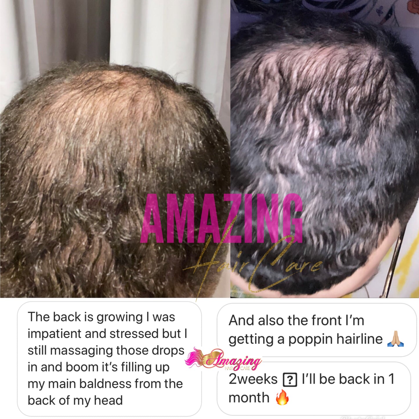 Scalp Stimulator Kit (MEN)