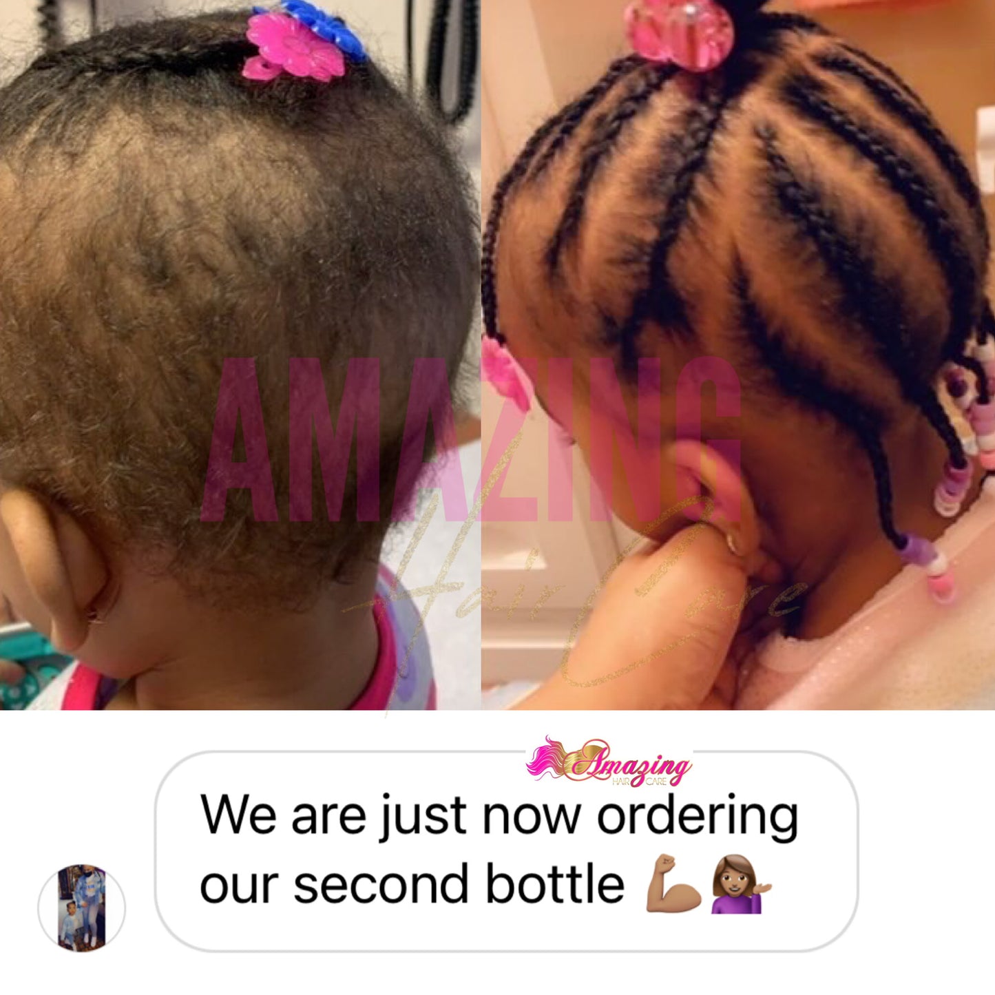 Hair Boom Drops (KIDS)