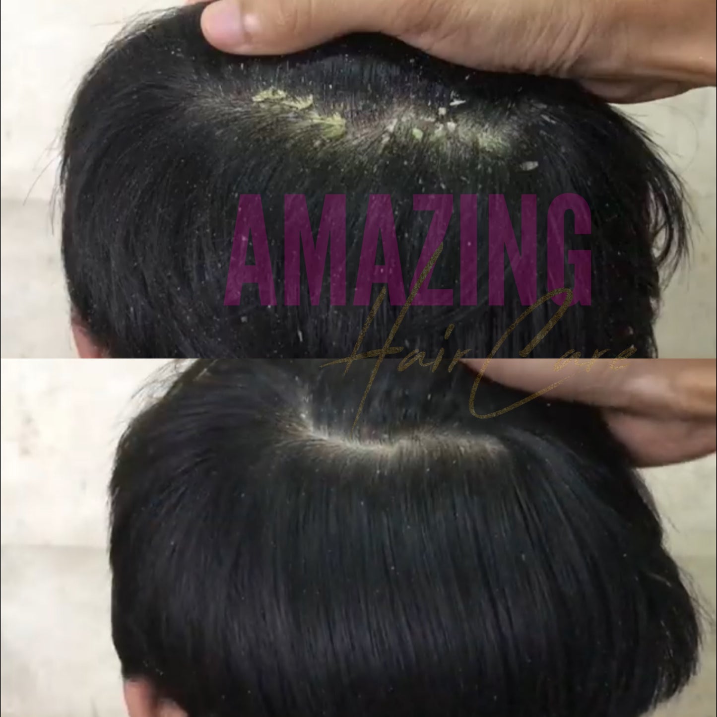 Scalp Repair System