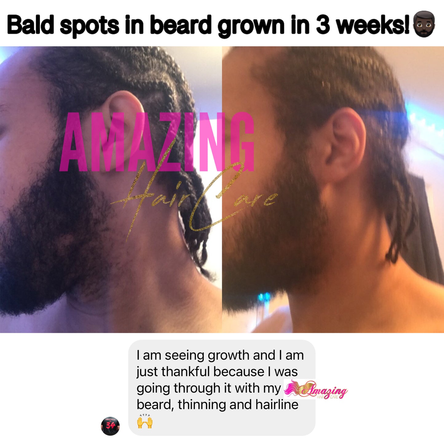 Hair and Beard Grow Kit (MEN)